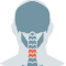 목